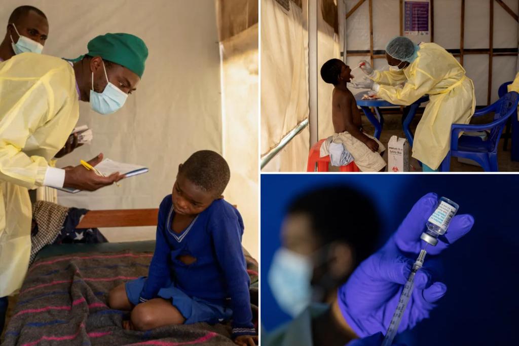 Mpox has been declared a public health emergency in Africa -- what is it and what is WHO doing?