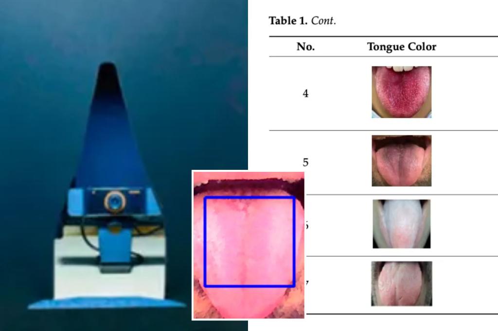 AI model 98% accurate in detecting diseases from a tongue photograph